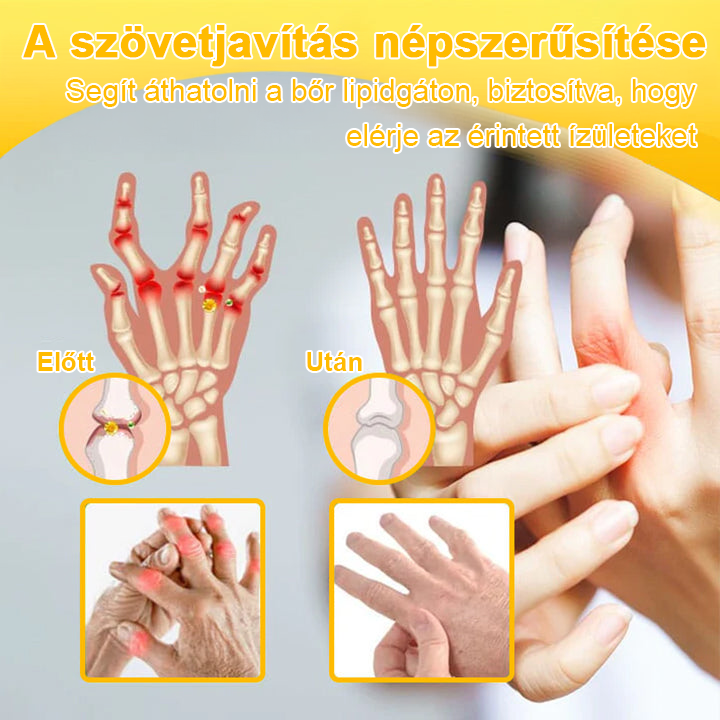 💎TLOPA® Botulinum Toxin és Méhméreg Fájdalomcsillapító Csontgyógyító Krém🐝 🔥(Kifejezetten időseknek & ortopéd szakorvosok ajánlásával)🦴