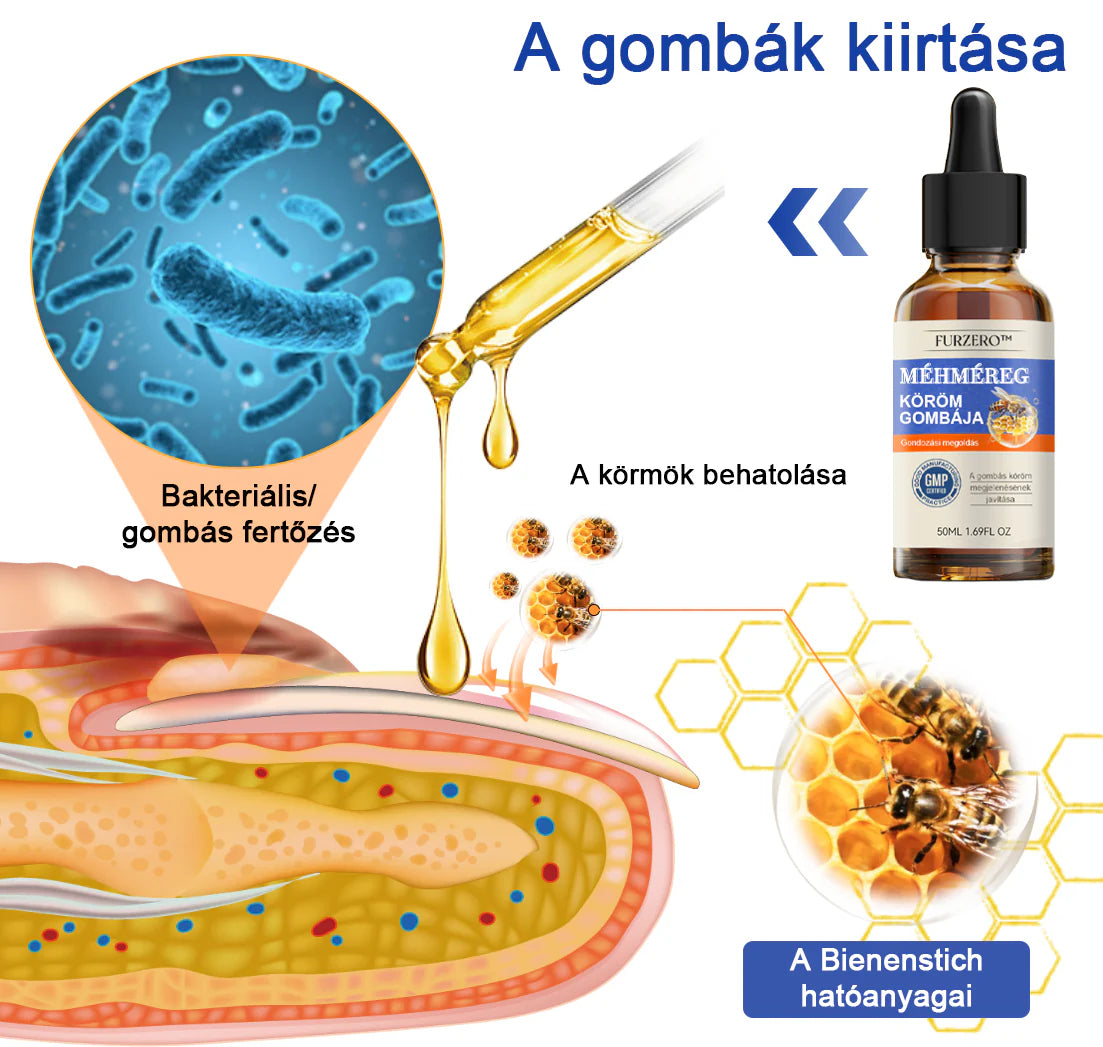 🐝Furzero™ Méhméreg Körömgomba Kezelőoldat: Teljes megoldás a körömgomba problémájára🌟👣👣（Az utánvétes fizetést）