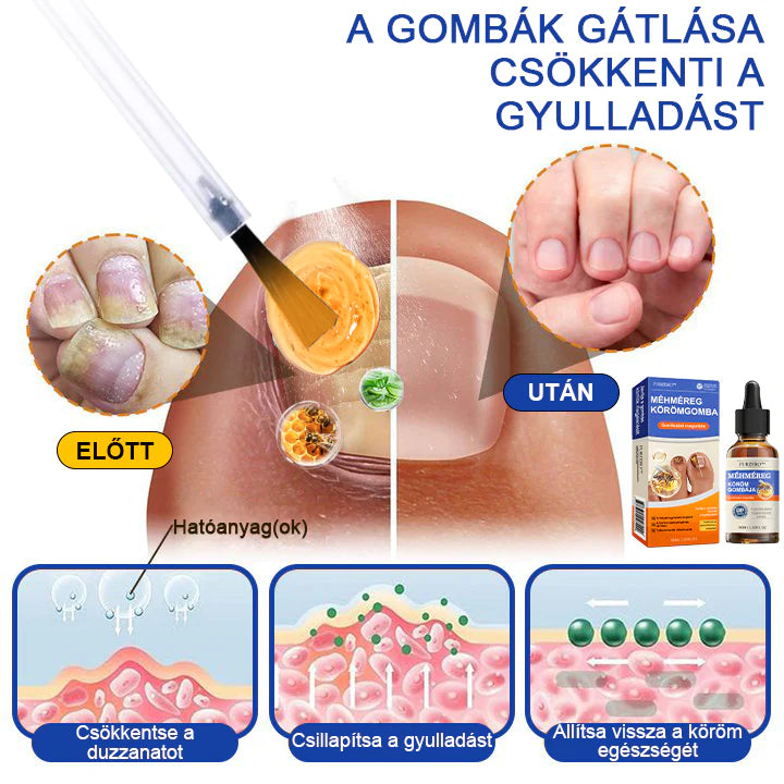 🐝Furzero™ Méhméreg Körömgomba Kezelőoldat: Teljes megoldás a körömgomba problémájára🌟👣👣（Az utánvétes fizetést）