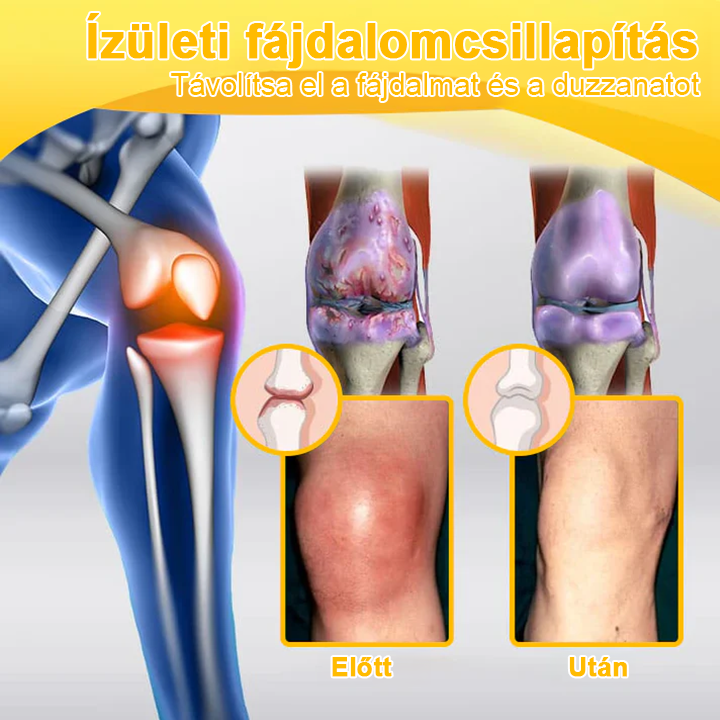 💎TLOPA® Botulinum Toxin és Méhméreg Fájdalomcsillapító Csontgyógyító Krém🐝 🔥(Kifejezetten időseknek & ortopéd szakorvosok ajánlásával)🦴